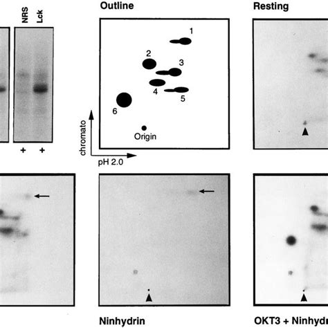 Tryptic Peptide Maps Of Lck Immunoprecipitated From Metabolically 32 P