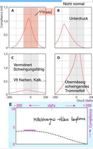 15 Klinik Des Auditiven Systems Karteikarten Quizlet