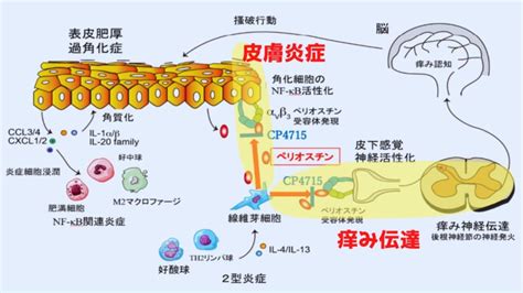 アトピー性皮膚炎の痒みの原因解明とその治療薬を発見 ナゾロジー