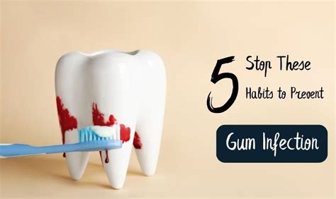 Stop These 5 Habits Now To Prevent Gum Infection By University Periodontal Associates Jan