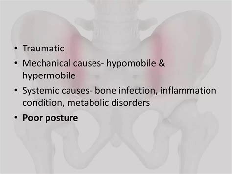 SI JOINT DYSFUNCTION.pptx