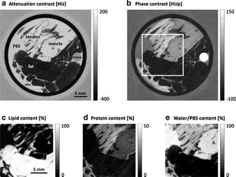 Quantitative X Ray Phase Contrast Computed Tomography With Grating