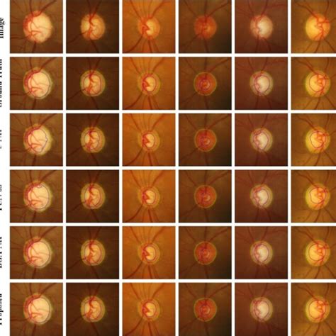 Visualization of optic disc and optic cup segmentation results in the ...