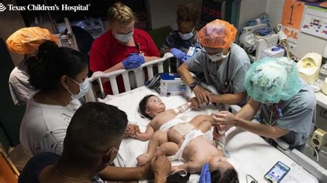 Logran separar con éxito a los gemelos Lucas y Mateo Es un regalo de