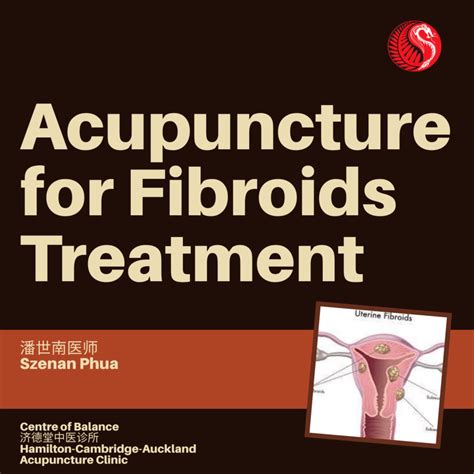 Acupuncture For Fibroids Treatment Best Acupuncture Hamilton Nz