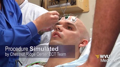 Diagram Electroconvulsive Therapy