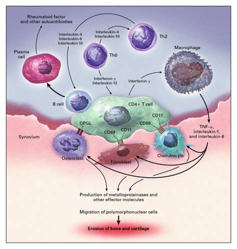 Cytokine Pathways and Joint Inflammation in Rheumatoid Arthritis | NEJM