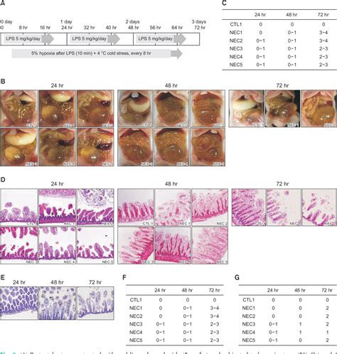 Figure From Suppressive Role Of Vascular Endothelial Growth Factor On