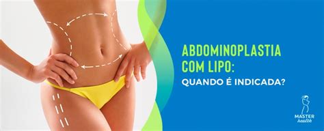 Abdominoplastia Lipo Quando Indicada Blog Master Health