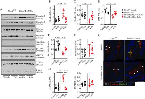 Aberrant Tight Junction Protein Patterns And Elevated STAT3