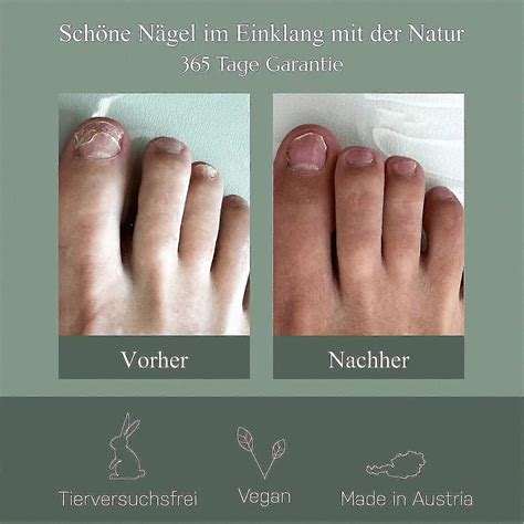 2024 -Nail Care Pen, Nail Fungus Austrian Experiences, Nail Care Pen