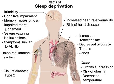 Sleep Deprivation Woes - Canyon News