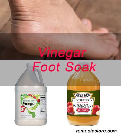 How To Remove Dry Skin From Feet With Vinegar - Remedies Lore