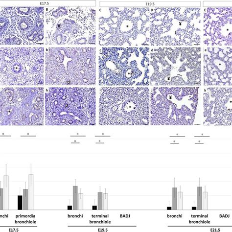 Protein Expression Pattern Of Calcitonin Gene Related Peptide Cgrp In