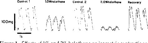 Figure From Effects Of Halothane On Electrophysiologic Properties And