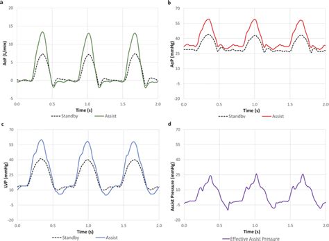 Representative hemodynamic waveforms sampled from the in vivo data; the ...