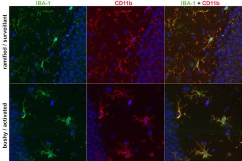 Cd B A Marker Of Activated Microglia