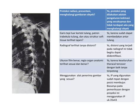 Ppt Kritisi Dan Evaluasi Radiograf Cervical Dan Thoracal Ppt