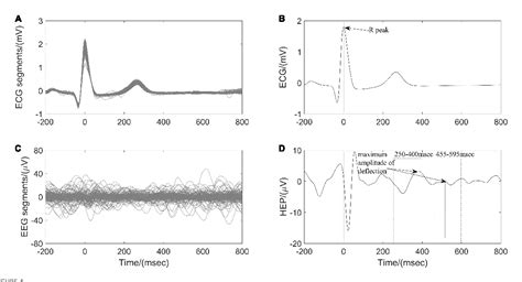 Figure 1 From Effects Of 24 H Acute Total Sleep Deprivation On