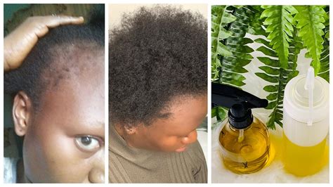 The Perfect Oil Mixture For Hair Growth Diy Oil Mix Youtube