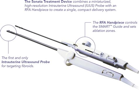 The Sonata® System - Gynesonics (US)