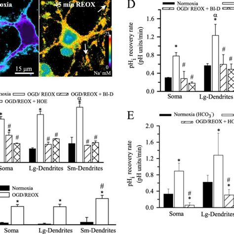 Differential NHE 1 Activity In Soma And Dendrites A 2 H OGD 1 H