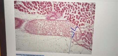 Solved Please Help Me Identify The Highlighted Structure Chegg