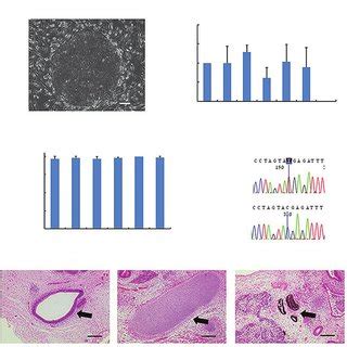 Generation Of IPS Cell Lines From An SCN Patient With HAX1 Gene