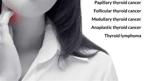 Types of Thyroid cancer