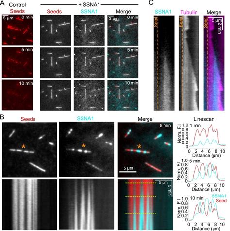 Ssna1 Inhibits Microtubule Severing By Spastin And Recognizes Sites Of