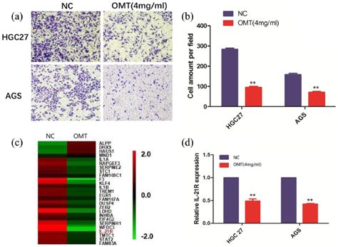 Omt Inhibits Cell Invasion And Il R Was Identified To Be Affected By