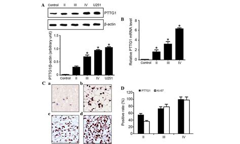 Inhibition Of Pttg1 Expression By Microrna Suppresses Proliferation And