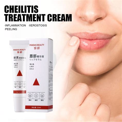 NGTEVOOS Clearance Special Offers Black Lip Breaking Essence Cream 15g