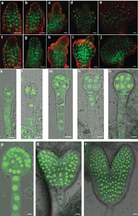 Attrm6 And Attrm61 Show A Similar Expression Pattern The Gfp