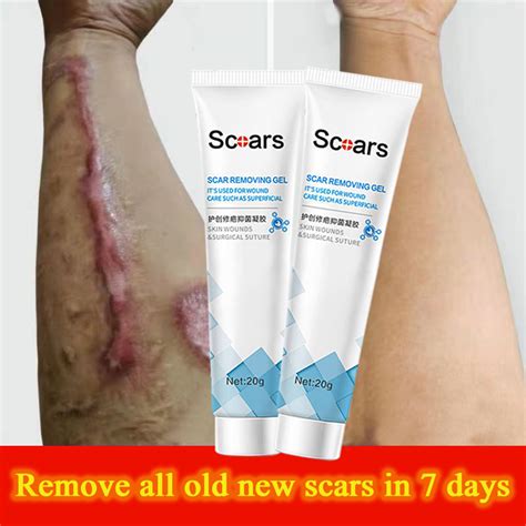 Scar Remover for Old Scar on Leg Scar Gel Original Stretch Mark Remover ...