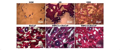 Histological Images In Higher Magnification Showing Newly Formed Bone