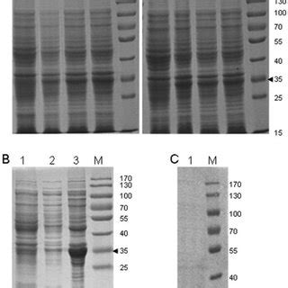 Expression Analysis And Expression Optimization Of The Recombinant