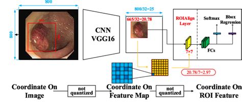 Figure 11 From Colon Polyp Detection And Segmentation Based On Improved