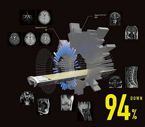 Echelon Smartmri T