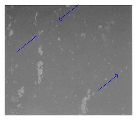 Morphology of apoptotic bodies in cells treated with 0.5 pM and 50 nM... | Download Scientific ...