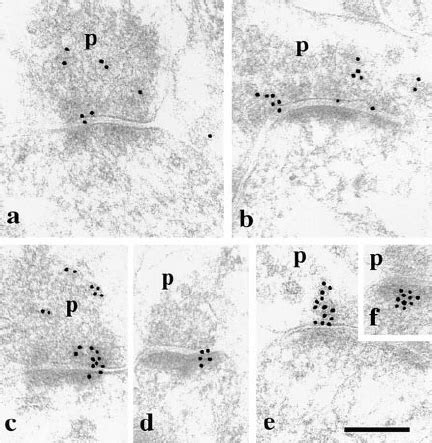 Targeting Of Recombinant Myc Tagged Narp To Excitatory Synapses From