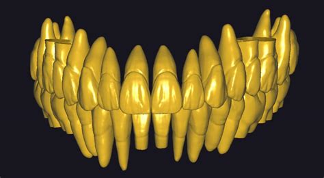Fichier Stl Biblioth Que Dentairedesign Pour Impression D