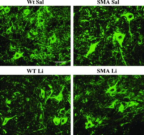 Lithium Reduces Smi Immunofluorescence In Sma Iii Mice