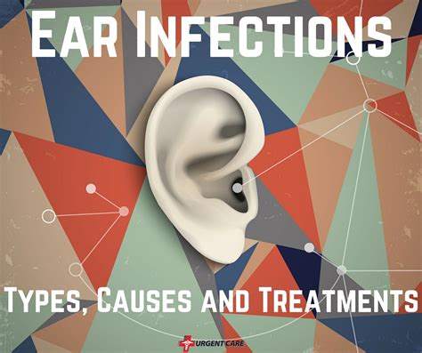 Ear Infections Types Causes Treatment Urgent Care Mississippi