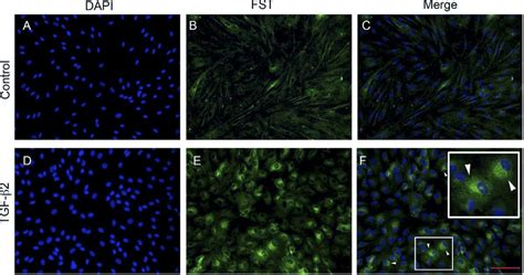 Tgf B Induces Fst Protein Expression In Primary Cultured Primary Tm