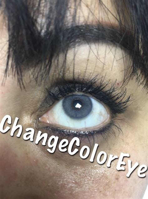 Laser Eye Color Change Uk Allright Weblog Stills Gallery