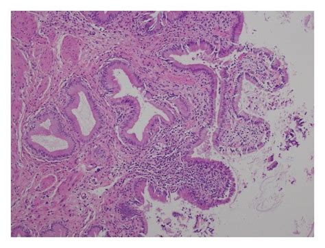 Gallbladder Histology Labeled