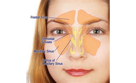 Sinus Diagram