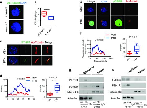 PTH Stimulates Transport Of PTH1R To Primary Cilia Of NP Cells A