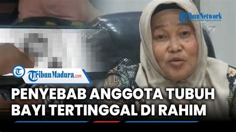 Tanggapan Dinkes Bangkalan Soal Dugaan Malpraktik Di Puskesmas